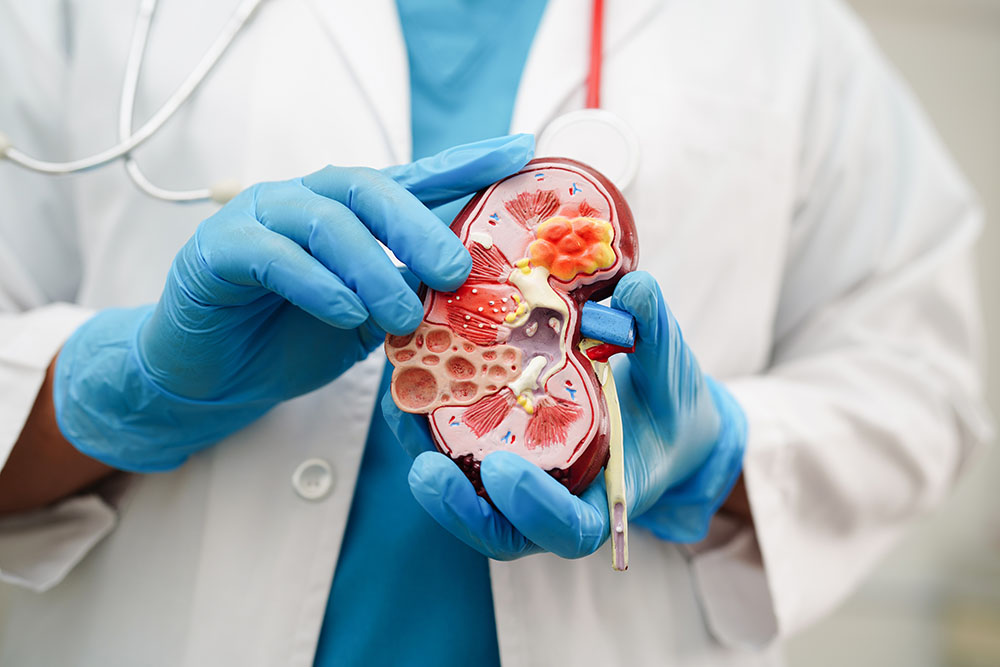 A person is holding a model of a kidney