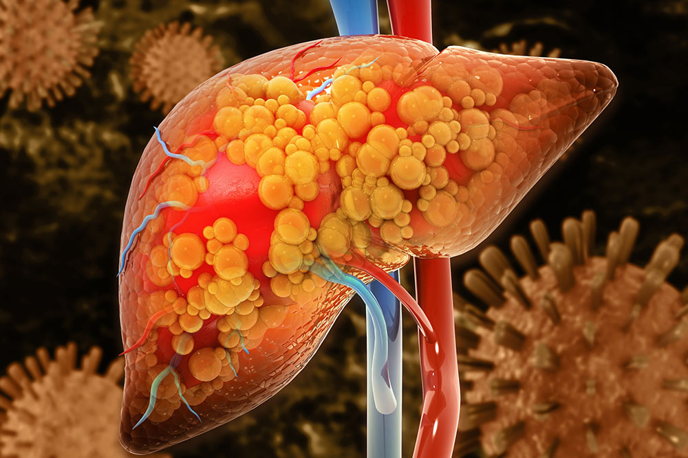 Anatomical depiction of the liver.