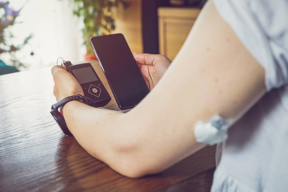 A woman is seated at a table holding a smartphone and a continuous glucose monitor, which is connected to a needle inserted at the back of her upper arm