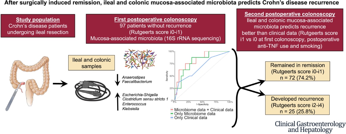 Illustration depicting how microbiota can predict the recurrence of Crohn’s disease. Accessible description available below. 