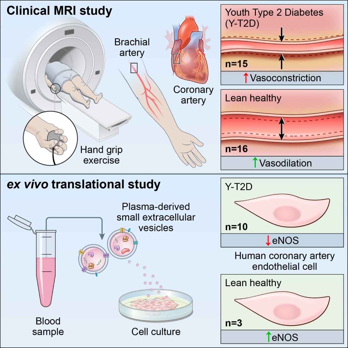 A graphical abstract depicting the clinical and translational experiments conducted to study pT2D. Accessible description available below. 