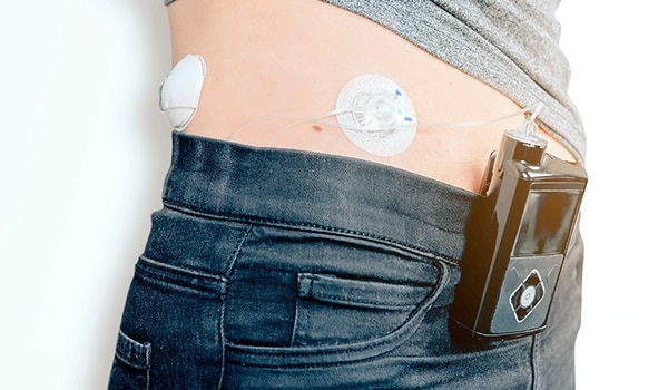 Best Practices for Inpatient Insulin Pump Use