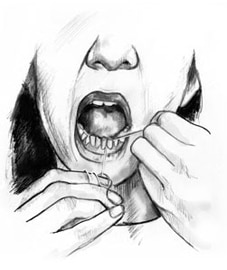 Drawing of a woman flossing her lower teeth.