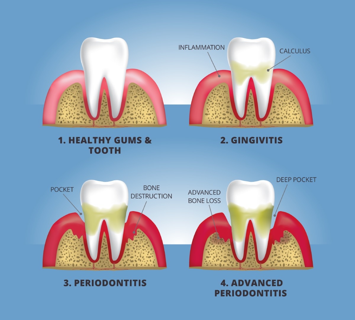 Can a toothache raise deals your blood pressure