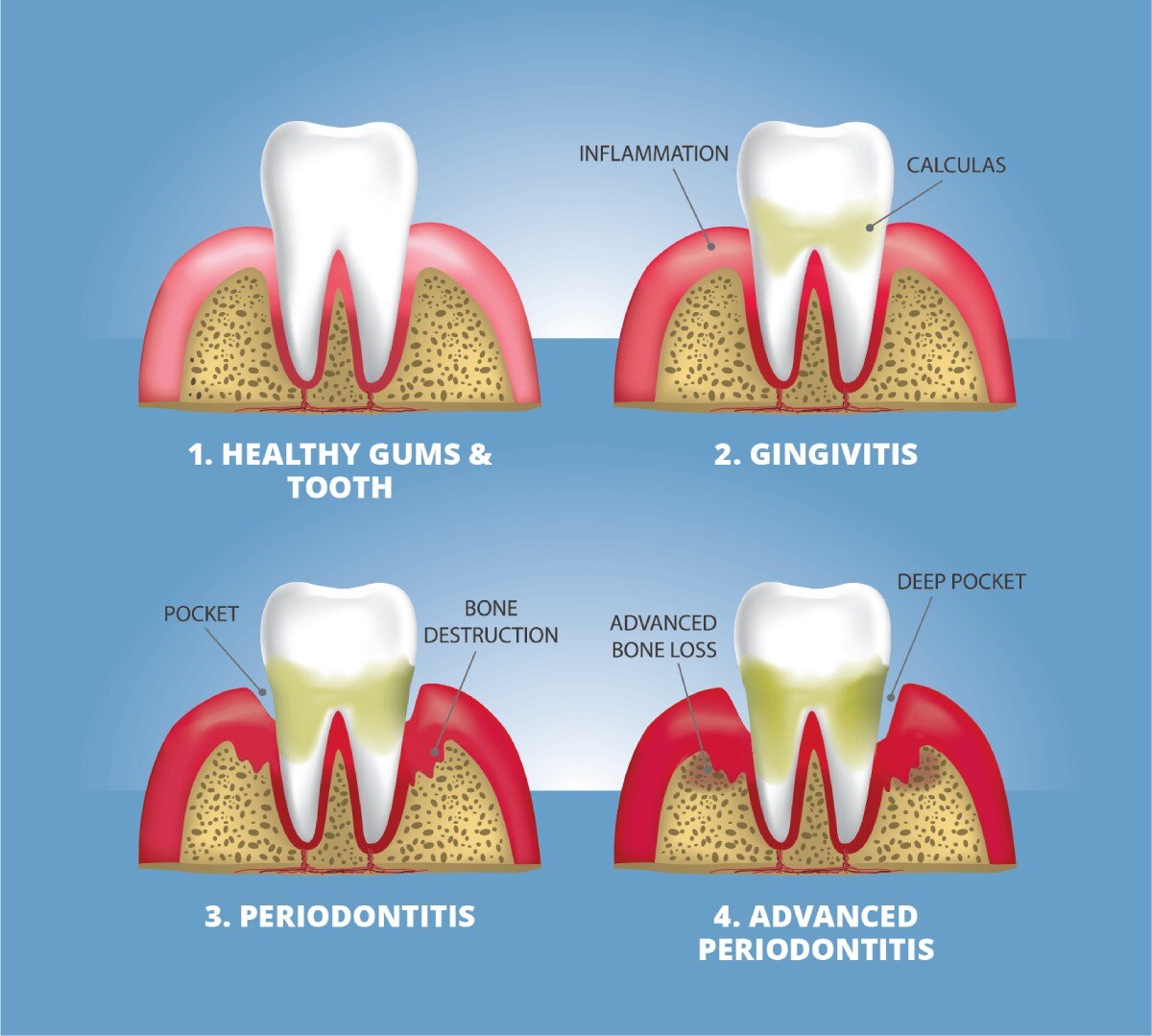 3 Easy Facts About Tips For Healthy Teeth And Gums - Sensodyne Shown ...