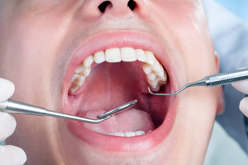 Diabetes, Gum Disease, & Other Dental Problems - NIDDK