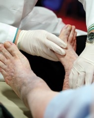 Photo of a doctor examining someone's bare feet.