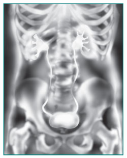 Urinary Tract Imaging - NIDDK