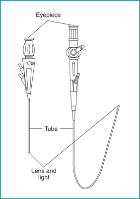 Endoscopy equipment and instruments rigid and flexible. Different