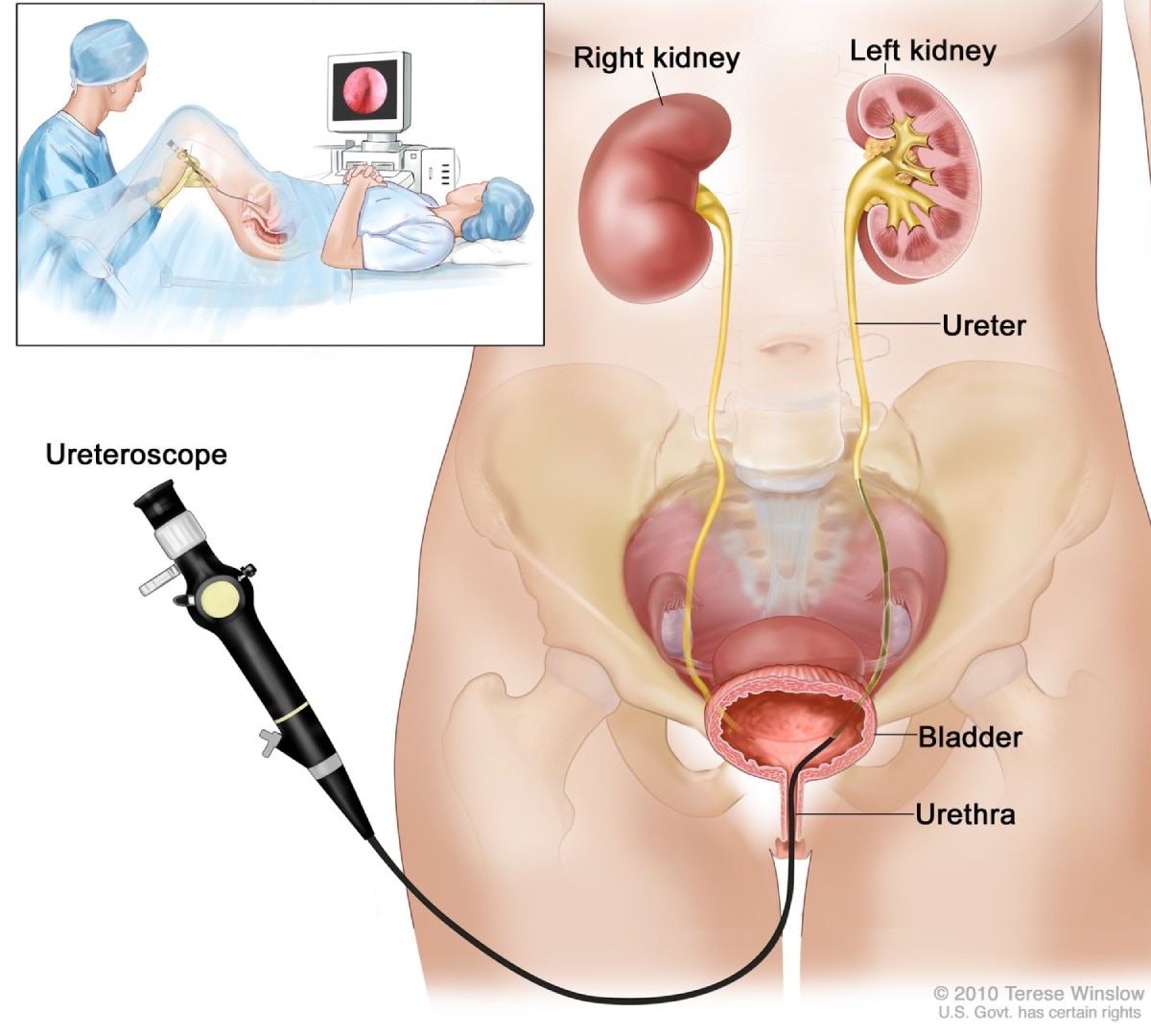 Diagnostic Procedures in the Evaluation of Female Urinary