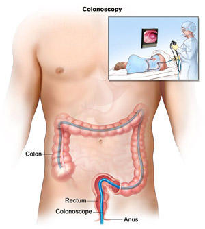 Colonoscopy testing and colon description