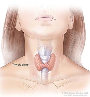 Graves Disease Niddk