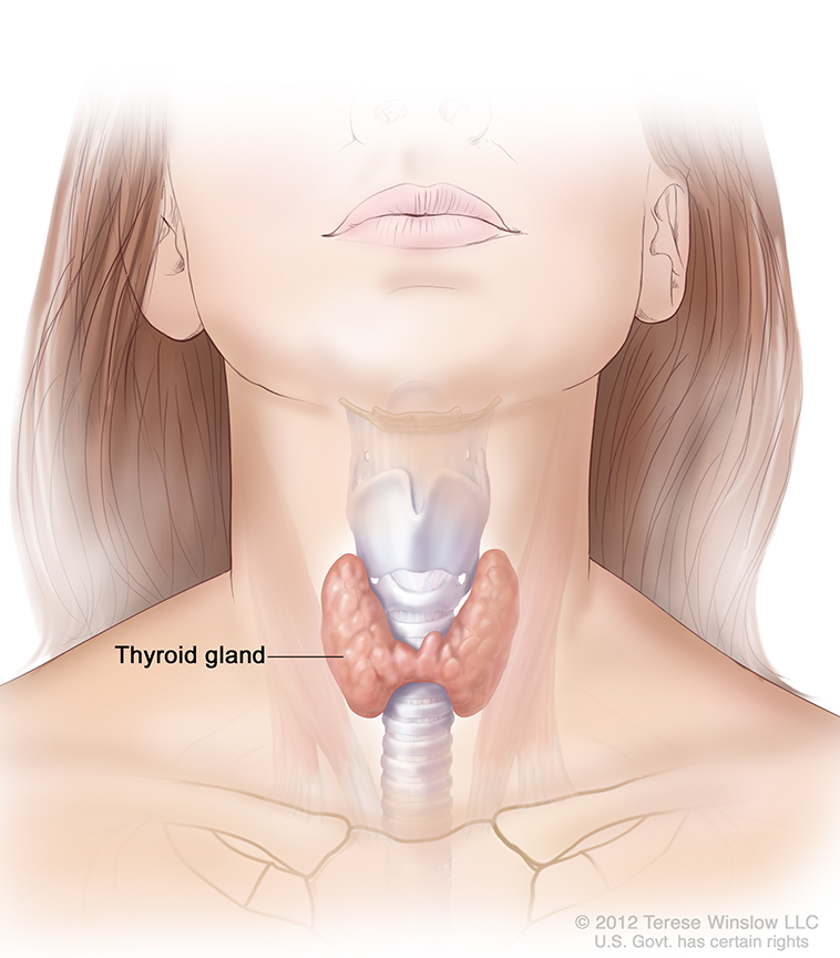 Iodine deals and hyperthyroidism