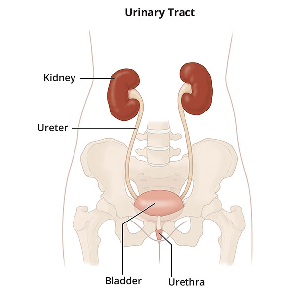 Interstitial Cystitis (Painful Bladder Syndrome) - NIDDK