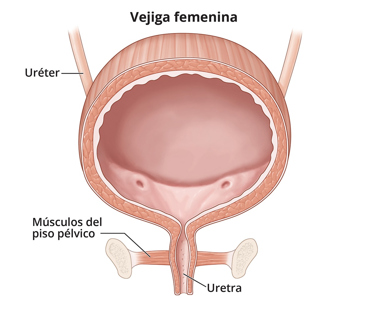 Síntomas y causas de los problemas de control de la vejiga (incontinencia urinaria) foto