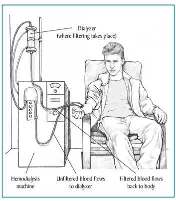 Treatment For Kidney Failure In Children Niddk