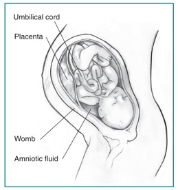 Urine Blockage in Newborns | NIDDK