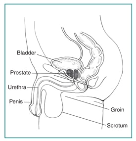Prostatitis: Inflammation of the Prostate | NIDDK