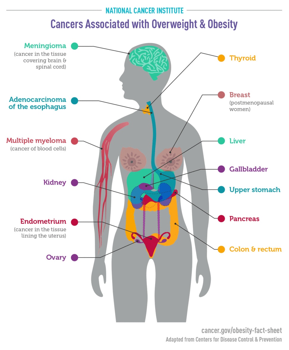 https://www.niddk.nih.gov/-/media/Images/Health-Information/Weight-Management/Understanding-Adult-Overweight-and-Obesity/cancers-associated-with-obesity-infographic_970x1174.jpg