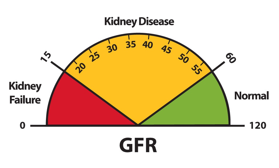 Stages Of Kidney Disease Gfr