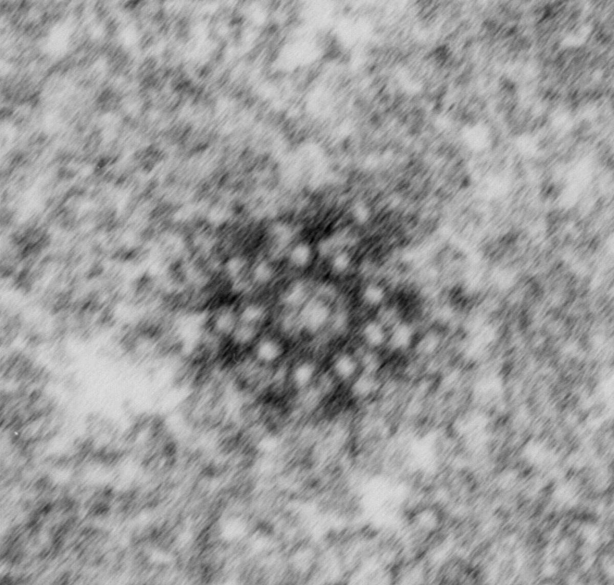 Electron micrograph of a C. elegans mother centriole