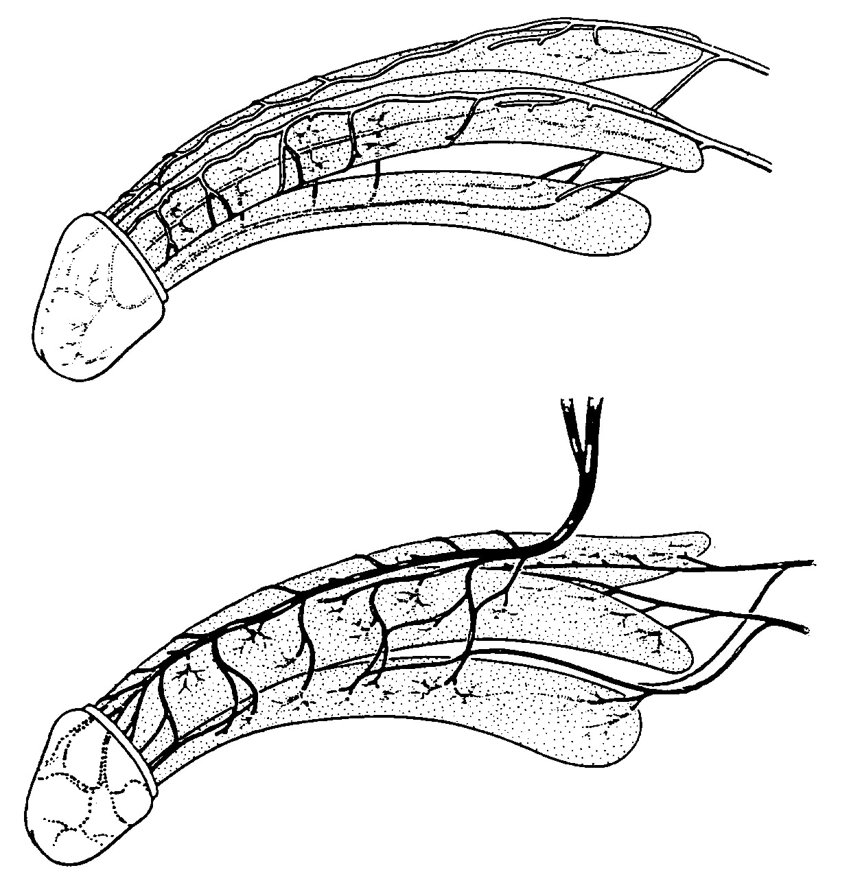 Two Illustrations Of The Penis The Top One Showing The Arteries Of The