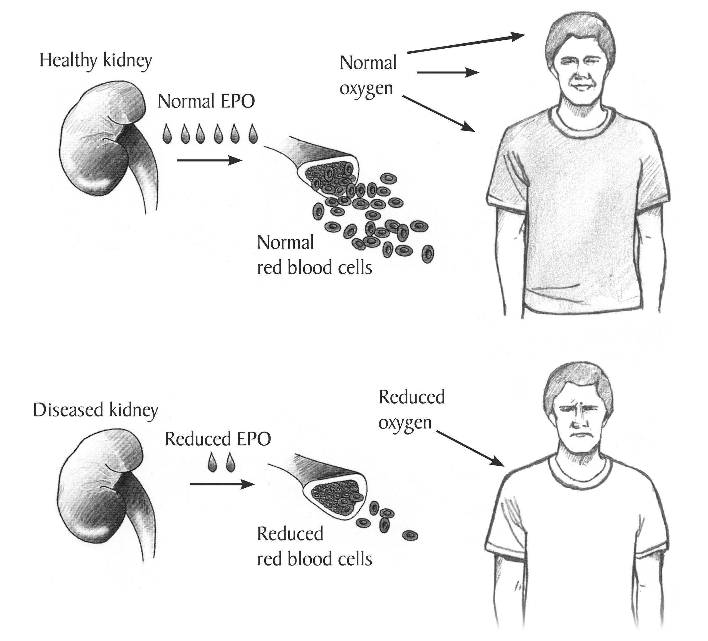 the-process-of-red-blood-cell-production-in-the-body-with-healthy-and