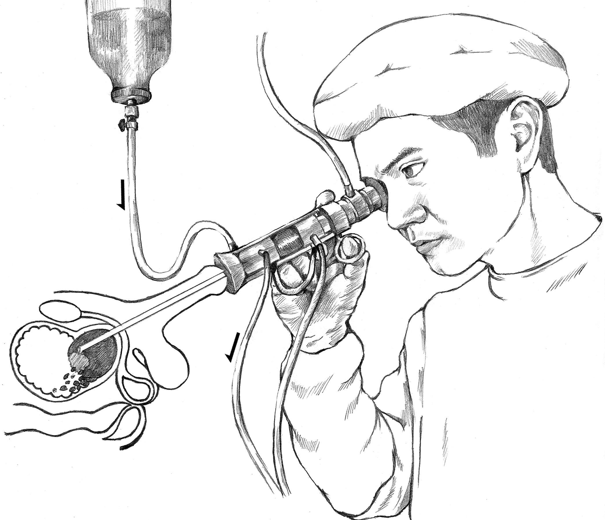 Doctor Performing A Transurethral Resection Of The Prostate Media Asset Niddk