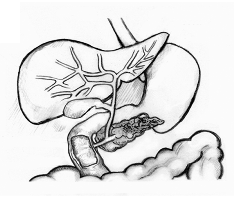 gallbladder drawing