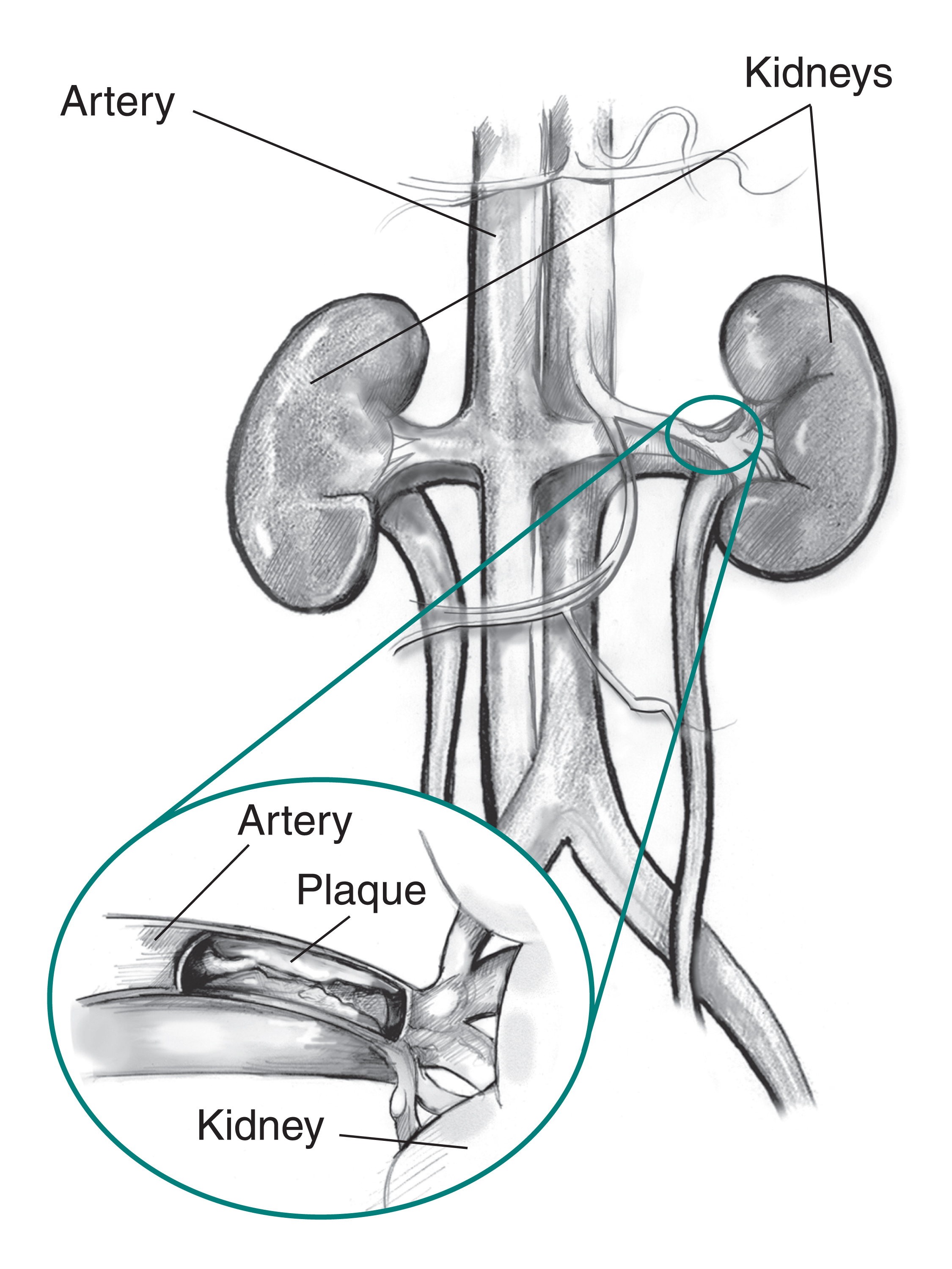 kidney anatomy model labeled