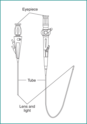 Drawing of a rigid cystoscope and a flexible ureteroscope with eyepieces, tubes, and lenses and lights labeled.
